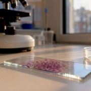 Laboratory slide showing blood cells under microscope