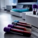 Blood tubes prepared for inflammation marker testing