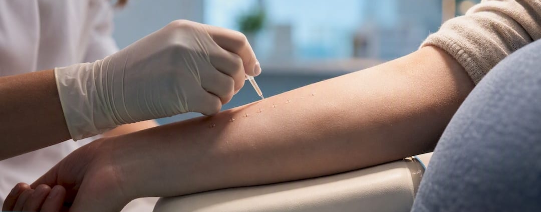 Skin prick allergy testing during pregnancy
